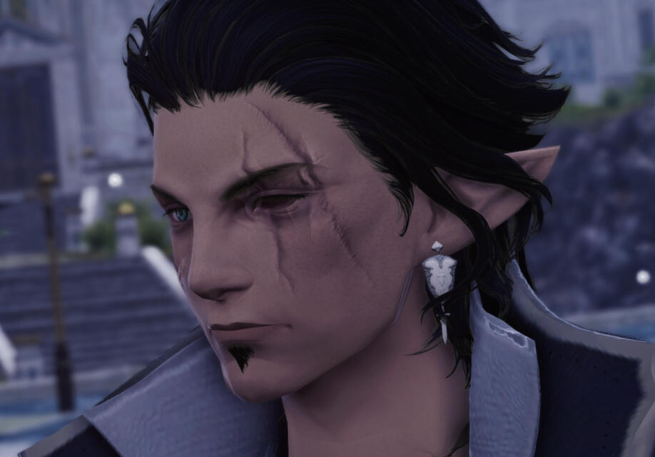 Facial scarring + Missing eye