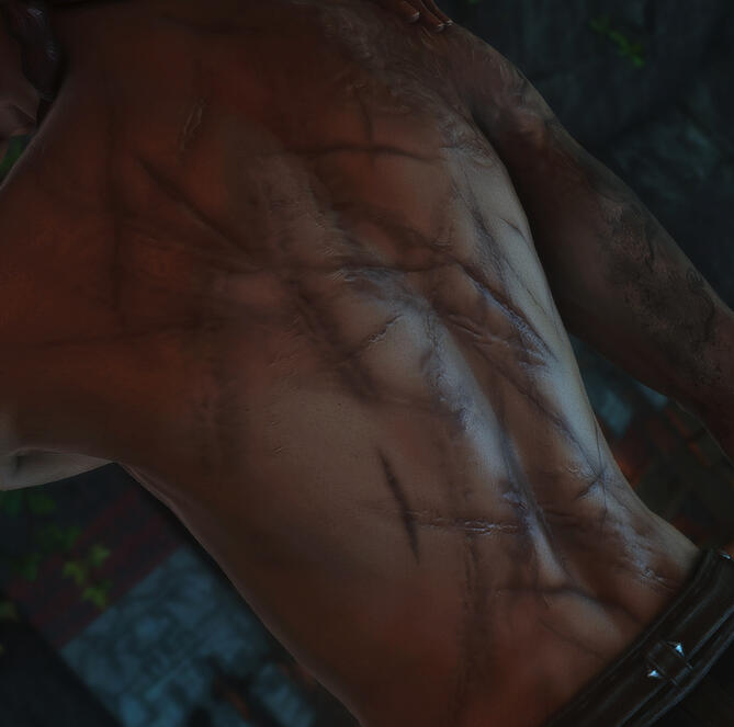 Various back scars