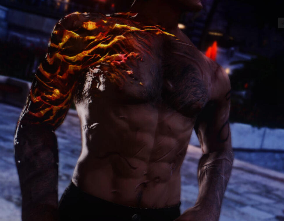 &#39;Tempered flame&#39; scarring &amp; various scars